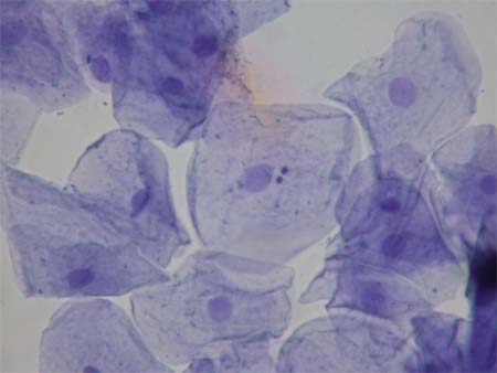 Cells viewed through a microscope
