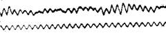 The first EEG recording, obtained by Hans Berger in 1929.