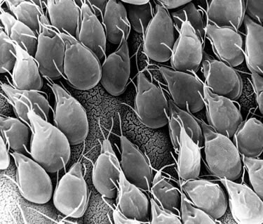 Giardia infected intestinal tract