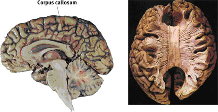 the divided brain     