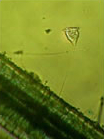 Protozoa