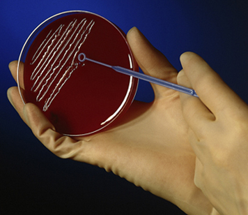 Petri dish