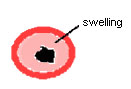 swelling