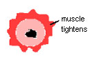 muscle tightness