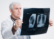 Male doctor examining an x-ray